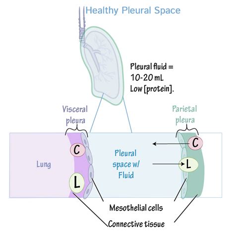 Pleural Effusions In 2021 Pleural Effusion Pathology Physiology Images