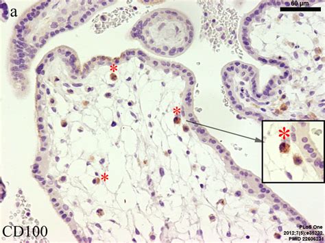 Fileplacenta Hofbauer Cells 01 Embryology