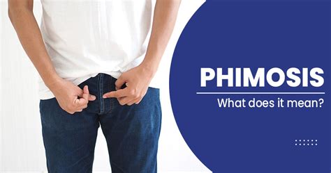 Phimosis What Is It Causes Symptoms And Treatments