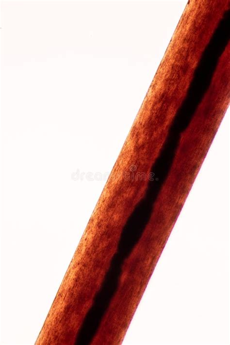 Hair Cell Of Human Under Microscope View Stock Photo Image Of