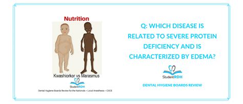 Q Which Disease Is Related To Severe Protein Deficiency And Is