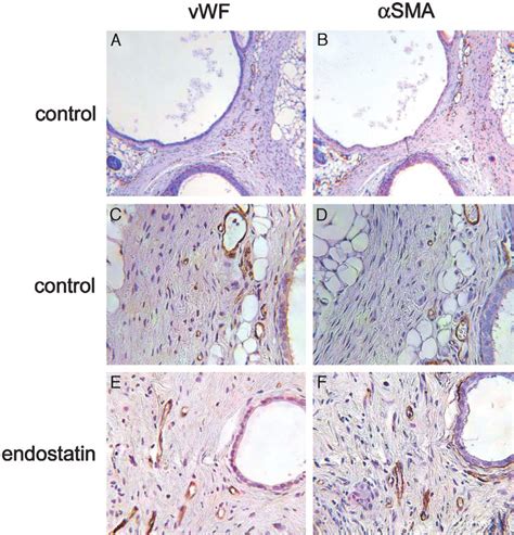 Vwf And Sma Staining Of Vessels In Endometriosis Lesions In Nude Mice