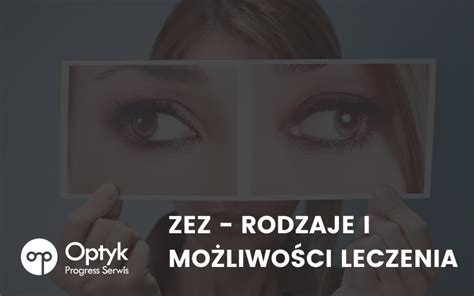 Zez rodzaje i możliwości leczenia Optyk Szczecin Progress Serwis