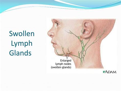 Ppt Lymphatic System Powerpoint Presentation Id2206087