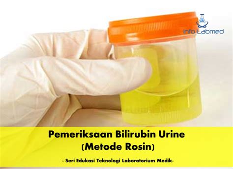 Pemeriksaan Bilirubin Urine Metode Rosin Seri Edukasi Teknologi Laboratorium Medik