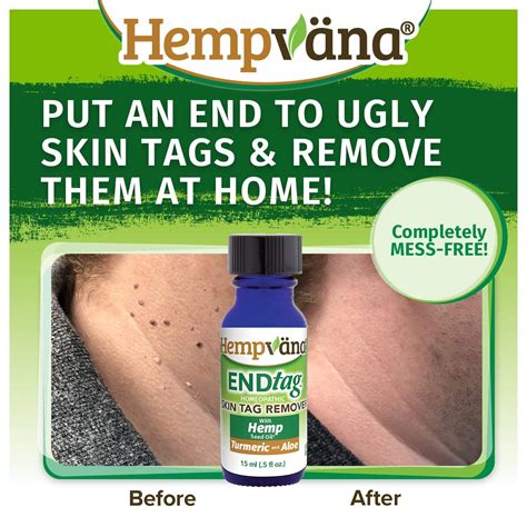 Wholesale Hempvana Endtag Skin Tag Remover Enriched With Hemp Seed Oil