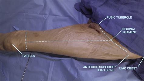 Proximal Lower Extremity Guided Anatomy