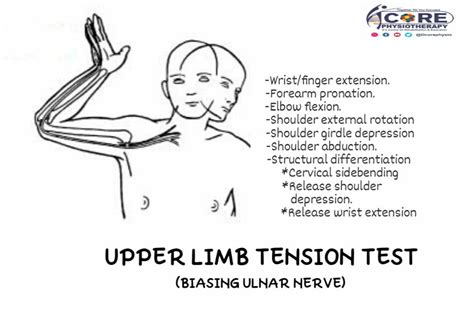 Dcore Physio Upper Limb Tension Test Biasing Ulnar Nerve