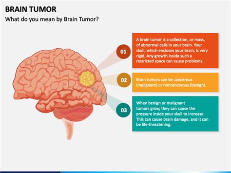 Brain Tumor Powerpoint Template Ppt Slides