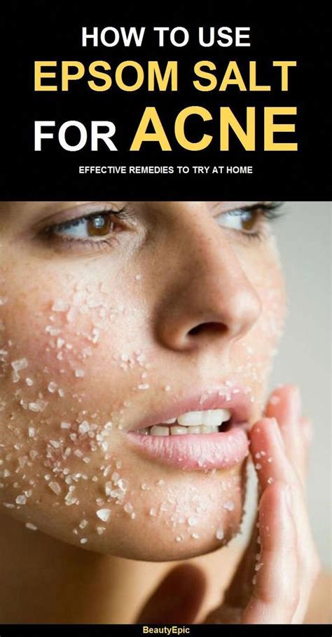 5 Easy Ways To Get Rid Of Acne Fast With Epsom Salt