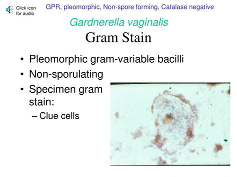 Ppt Aerobic Gram Positive Bacilli Part Ii Genital Culture Unit