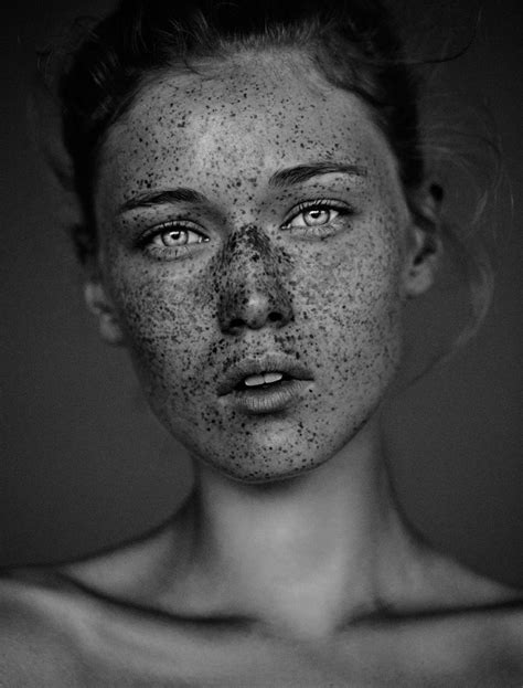 Gallery20780063the Freckles Project