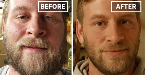 10 Before And After Pics Of People Who Gave Up Drinking And Became