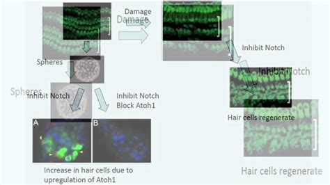 Recovery Of Hearing By Regeneration Of Auditory Hair Cells Youtube