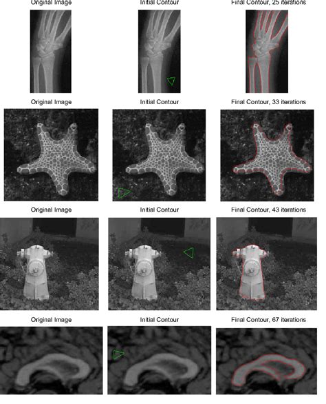 Figure 9 From An Efficient Local Chan Vese Model For Image Segmentation