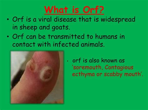 Ppt Orf Disease Powerpoint Presentation Free Download Id2213593