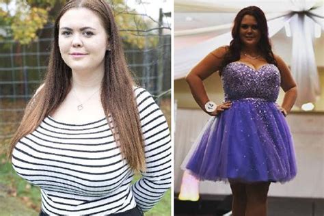 Mum Whose Breasts Don T Stop Growing Makes Desperate Plea For Breast Reduction Surgery
