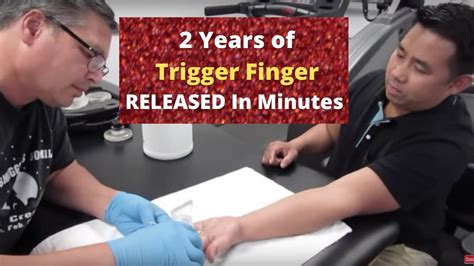 2 Years Of Trigger Finger Released In Minutes Real Results