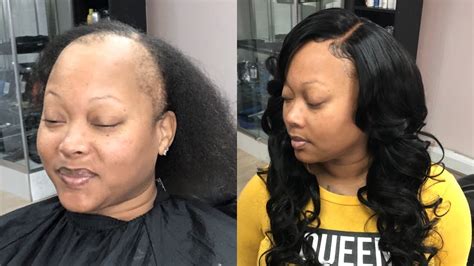 GLUELESS CLOSURE SEW IN ALOPECIA CLIENT Bouncy Layered Curls