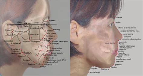 Diagram Showing The Reference Planes And Cephalometric Landmarks Used Download Scientific