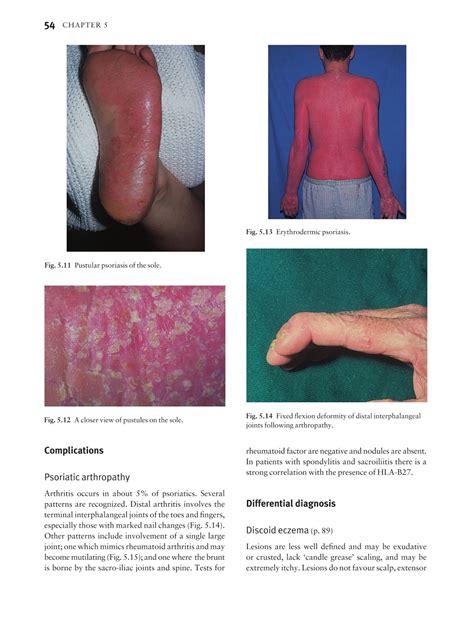 Medicine By Sfakianakis G Alexandros Skin Disease In Perspective 4