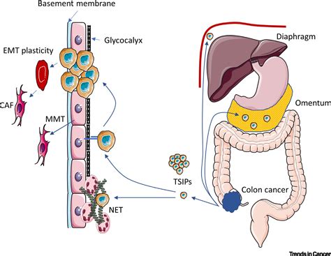 Targeting The Tumor Microenvironment In Colorectal Peritoneal Metastases Trends In Cancer