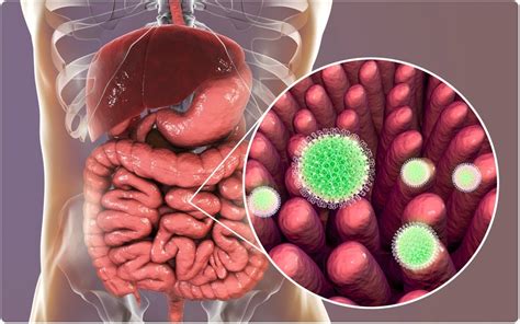 Adults who get rotavirus disease tend to have milder symptoms. 'Stomach flu' vaccine prevents type 1 diabetes in children