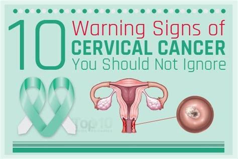 10 Warning Signs Of Cervical Cancer You Should Not Ignore Top 10 Home Free Nude Porn Photos