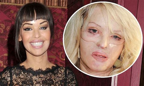 Pin On Katie Piper