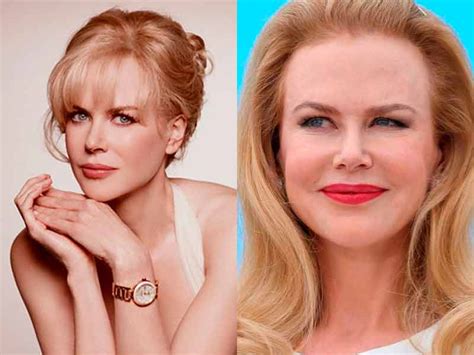 Nicole Kidman 20 Actores Antes Y Después De Pasar Por Quirófano