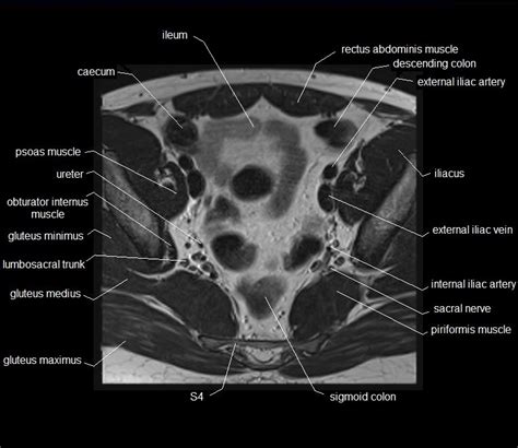 Mri Pelvis Anatomy Free Male Pelvis Axial Anatomy