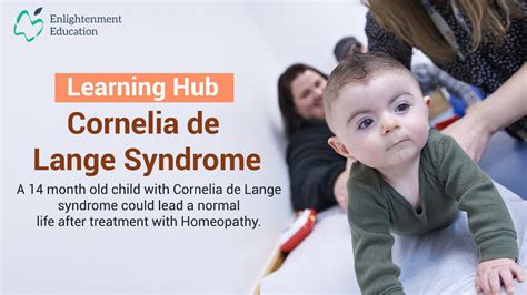 Learning Hub Homeopathic Case Study 14 Case Of Cornelia De Lange