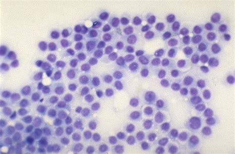 Cytology Histiocytoma In Dogs Canis Vetlexicon