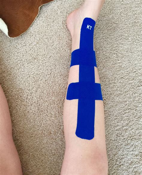 Got Some Kt And Taped My Shin Splint Well See How It Goes So Far It