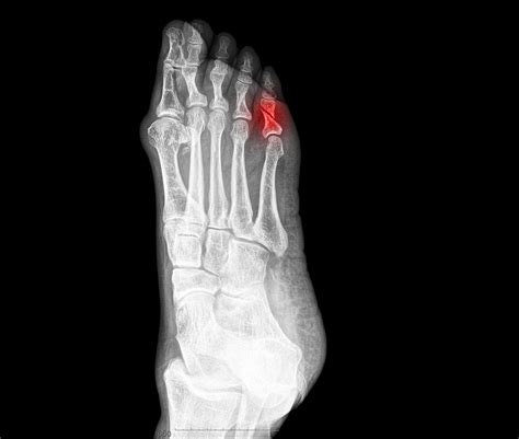 röntgen gründe ablauf röntgenbilder risken kosten praktischarzt