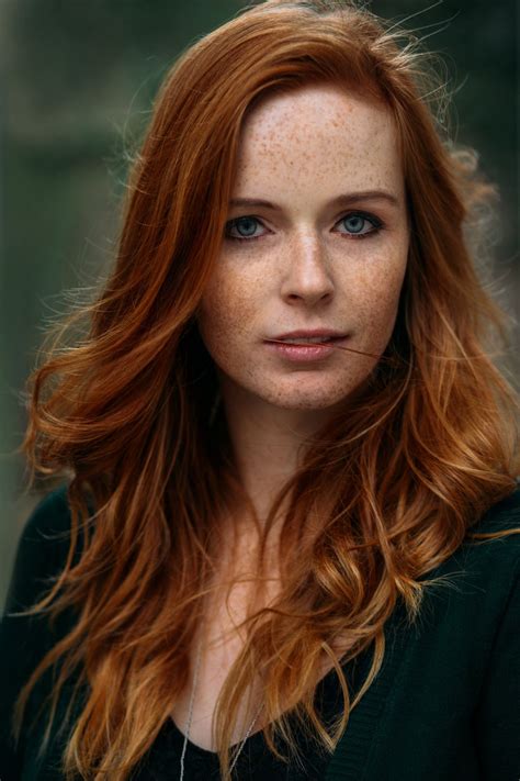Pin By Shalkadoctor On Beautifully Ginger Beautiful Freckles