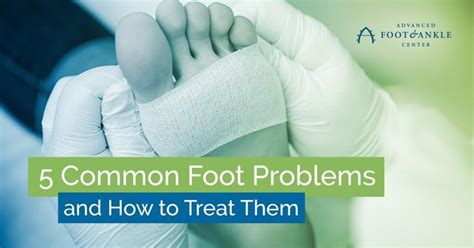 5 Common Foot Problems And How To Treat Them Advanced Foot And Ankle Center Podiatry