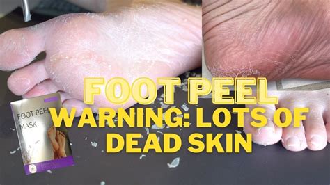 Oddly Satisfying Foot Peel Lavender Foot Peel Mask Review Youtube