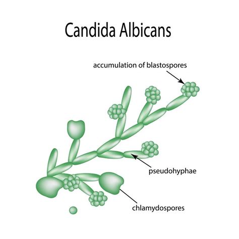 Candida Albicans Symptoms Diagnosis And Treatment Ph