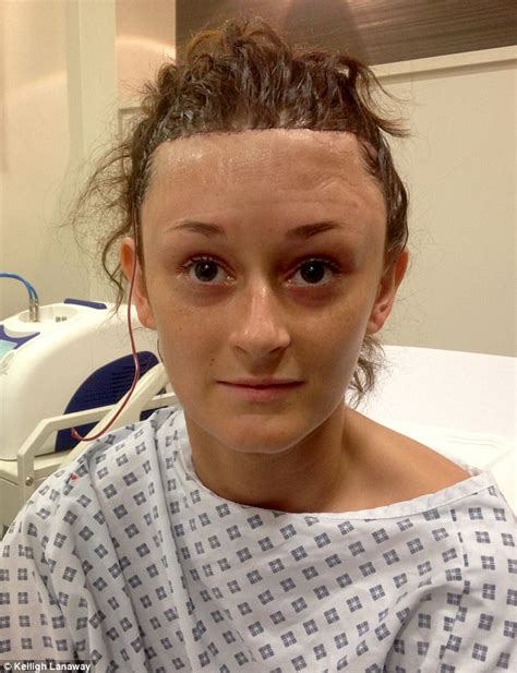 Kent Woman Bullied For Large Forehead Got £6500 Surgery Daily Mail