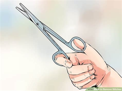 How To Remove Stitches 15 Steps With Pictures Wikihow