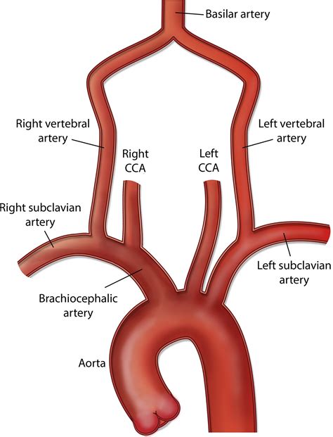 Image Result For Carotid Artery Carotid Artery Vertebral Artery The