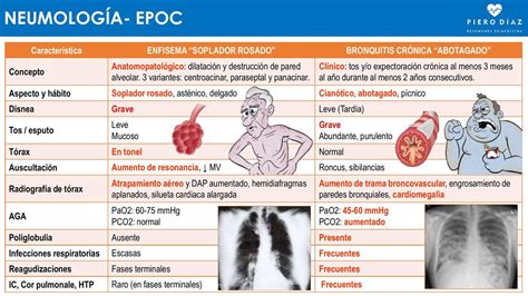 BRONQUITIS VS ENFISEMA EPOC Pierodiaz Med UDocz