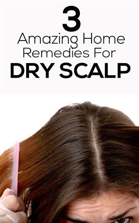 3 Amazing Home Remedies For Dry Scalp Dry Scalp Dry Scalp Remedy