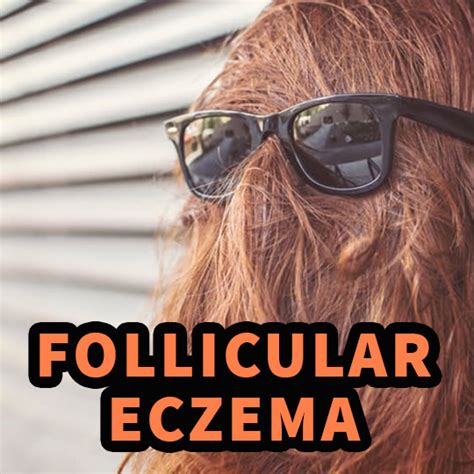 Follicular Eczema An Overview And What To Do