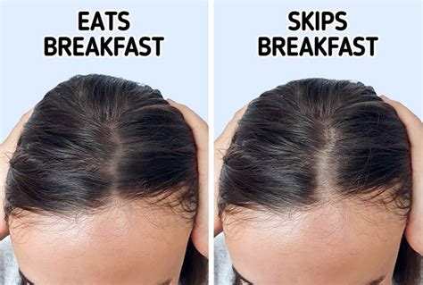 10 Daily Habits That Are Causing Your Hair To Thin Bright Side