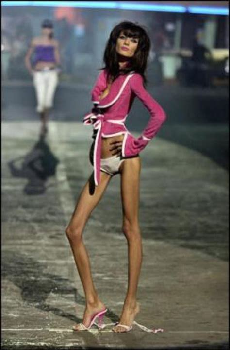 50 Most Funny Skinny Pictures That Will Make You Laugh