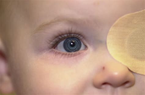 Emory Eye Center Leads Five Year Study On Infants Vision After