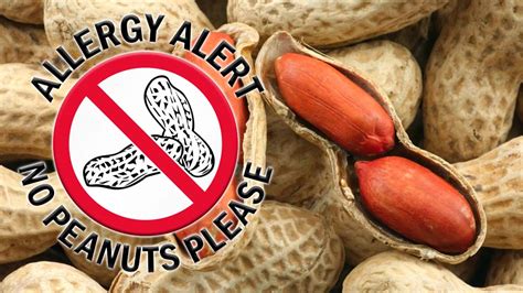 People With Peanut Allergies Have An Abundance Of Allergy Causing