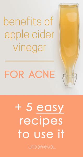 5 Recipes To Use Apple Cider Vinegar For Acne Urban Gyal